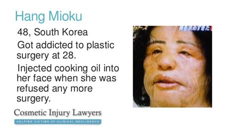 Cosmetic Surgery Disasters