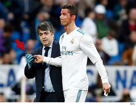 Cristiano Ronaldo Checks Bloody Face with Phone After Head ...