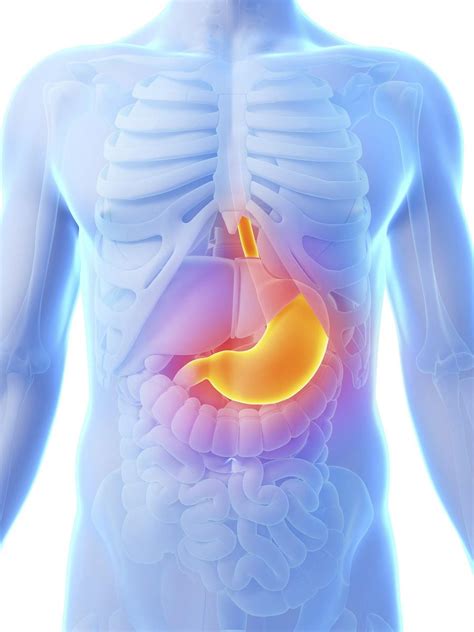 Cuáles son los primeros síntomas del cáncer de estómago