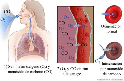 Cuidado con la intoxicacion por monoxido de carbono