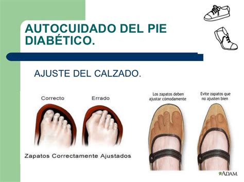 Cuidados del pie en diabeticos