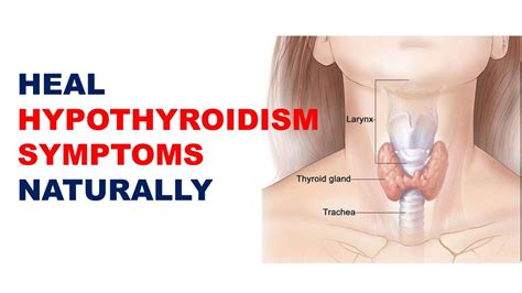 Cure Hypothyroidism Symptoms in Women, Heal Symptoms of ...