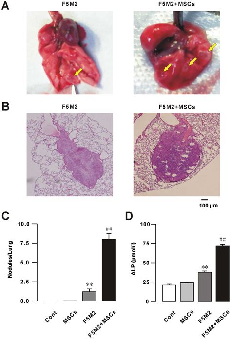 CXCR4 mediated osteosarcoma growth and pulmonary ...