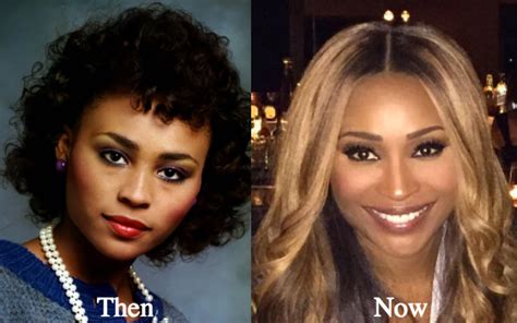 Cynthia Bailey Plastic Surgery Before and After Photos