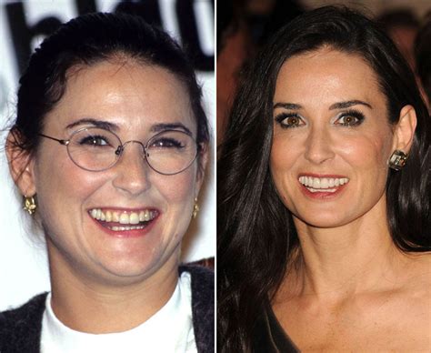 Demi Moore then and now teeth | Celebrity teeth ...