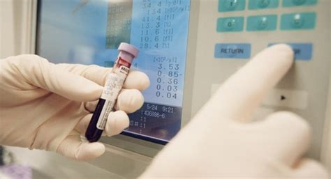 Descubren una nueva prueba de sangre que detecta el cáncer