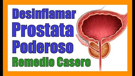 DESINFLAMAR LA PROSTATA DE FORMA NATURAL Remedios Caseros ...