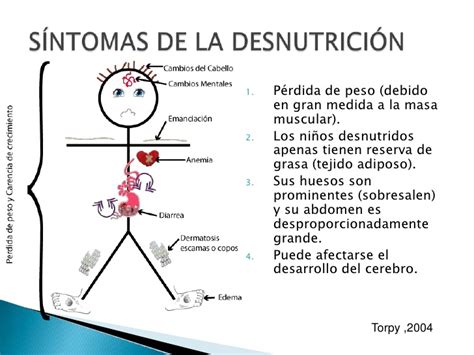 Desnutricion Y Bajo Peso