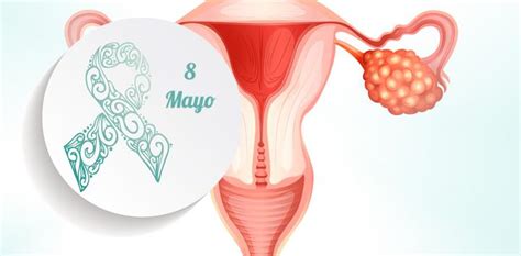 Día Mundial del Cáncer de Ovario, detectarlo a tiempo ...