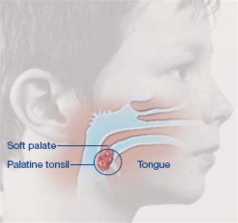 Diagram Of Tonsil Stones Location Thyroid Gland Location ...