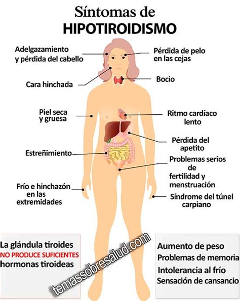 Diferencia Entre El Hipotiroidismo De Hashimoto Y El ...