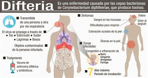 Difteria | Nuevo Laredo Noticias
