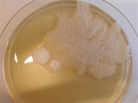 Dimorphic fungus   Wikipedia
