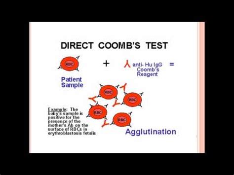 Direct Coombs Test   YouTube