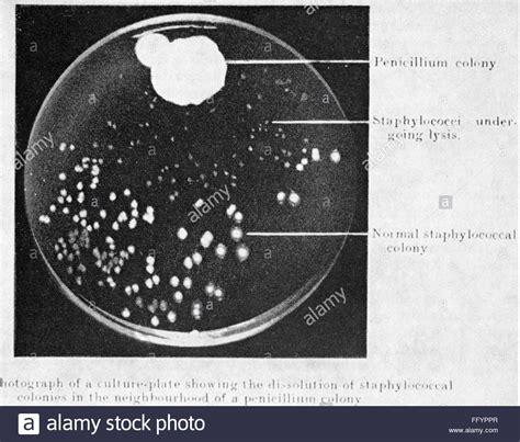 Discovery of penicillin by Alexander Fleming, 28.9.1928 ...