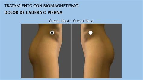 Dolor de cadera o pierna Tratamiento con biomagnetismo #27 ...