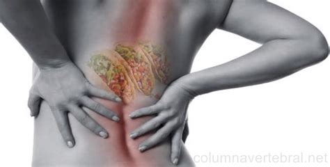 Dolor de espalda por causas alimenticias   Columna Vertebral