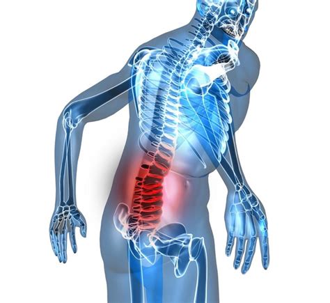 dolor de espalda – mariavillalbaquiromasaje