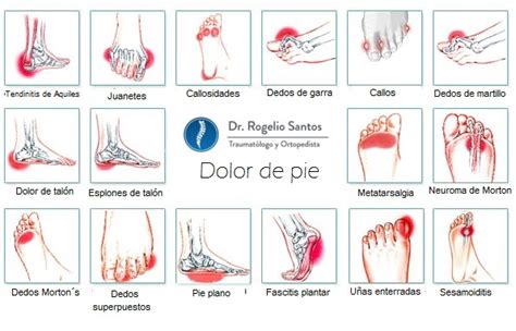 Dolor de pie • Dr. Rogelio Santos