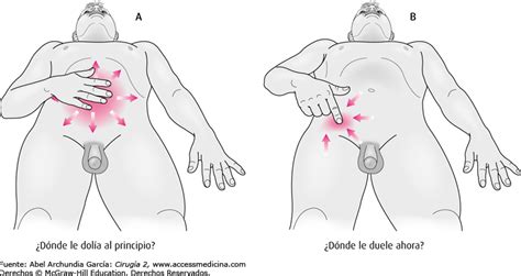 Dolor en mesogastrio  periumbilical .   Ciencia Explicada