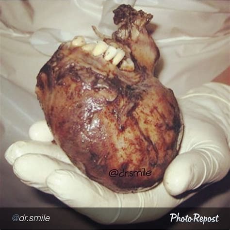 @Dr.albertomeza — by @dr.smile “Teeth on a heart? It’s ...