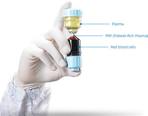 Dr. PRP USA   State Of The Art PRP Kit   Platelet Rich Plasma