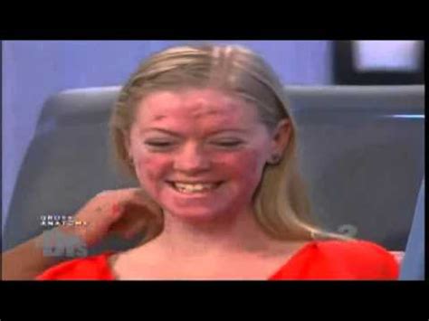 Dr. Sandra Lee treating an aggressive form of acne, acne ...
