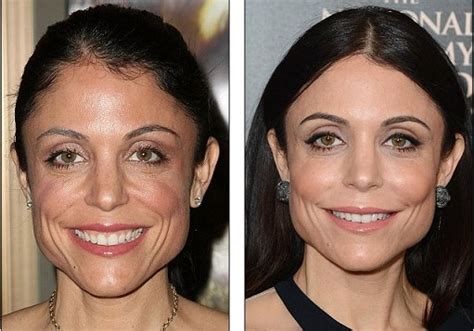 Dr. Terry Dubrow Gives His Opinion on Bethenny Frankel s ...