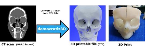 Easily Convert Medical Scans to 3D Printable Models Dicom ...