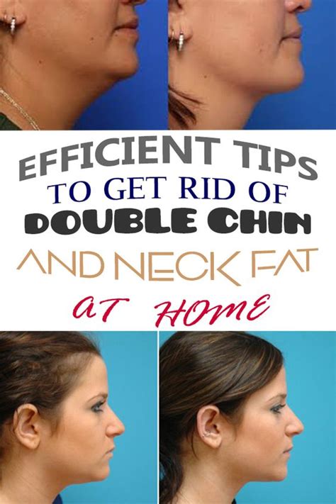 Efficient tips to get rid of double chin and neck fat at ...