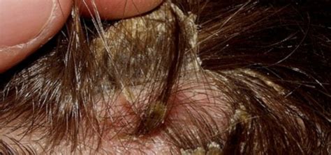 El cabello Fases de Crecimiento RAUL ROA ESTILISTA