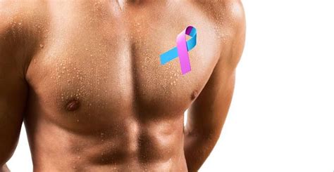 El cáncer de mama también afecta a los hombres – Galicia ...