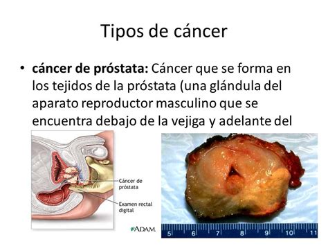 EL CANCER.   ppt video online descargar