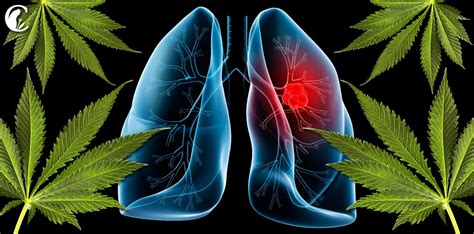 El cannabis y el cáncer de pulmón  1