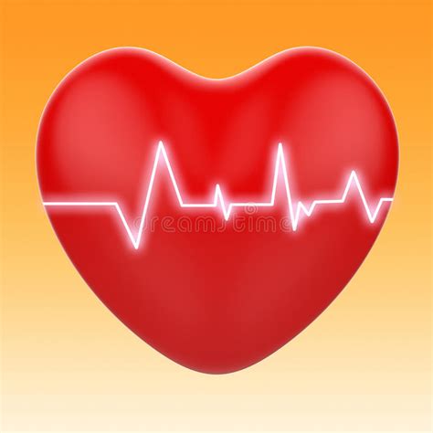 El Electro En Corazón Significa La Cardiología O El ...