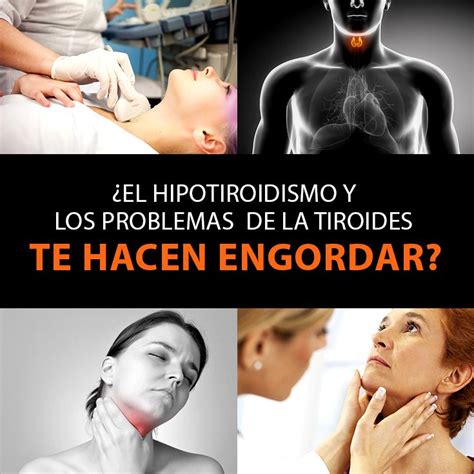 ¿El Hipotiroidismo Y Los Problemas De La Tiroides Te Hacen ...
