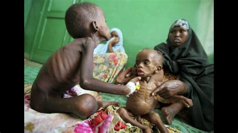 En Africa mueren miles de niños por falta de alimentacion ...