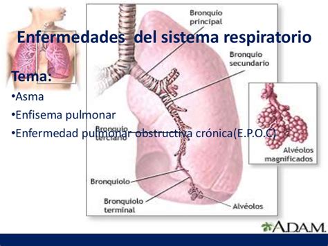 Enfermedades del sistema respiratorio