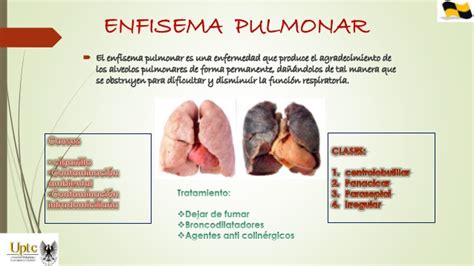 Enfermedades del Sistema Respiratorio