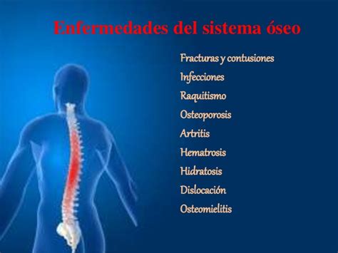 Enfermedades sistema óseo