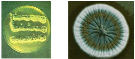 Enroque de ciencia: Del Treponema pallidum a la penicilina