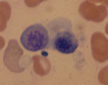 Eritroblasto basófilo, un eritroblasto.