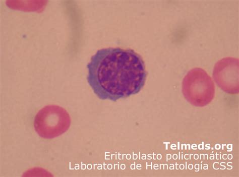 Eritroblastos; Eritrócitos Nucleados; Normoblastos ...