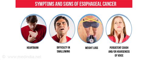 Esophageal Cancer   Types, Risk factors, Symptoms ...