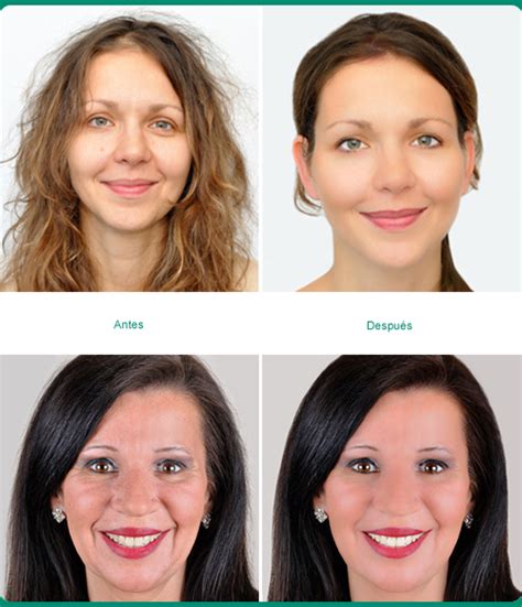 Estética Facial | Dra. Solange Azcarate