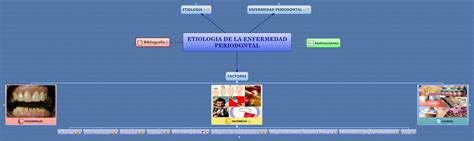 ETIOLOGIA DE LA ENFERMEDAD PERIODONTAL    XMind Online Library