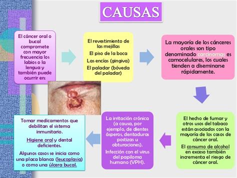 Exposicion patologia iii unidad cancer oral 1