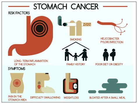 Facts About Stomach Cancer | Signs Of Stomach Cancer ...