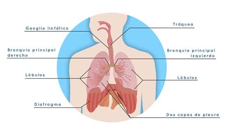 Fases del cáncer de pulmón   Roche Pacientes