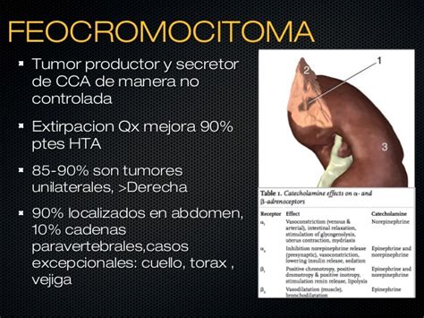 Feocromocitoma y anestesia